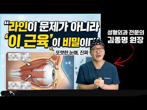 실패 없는 눈 성형의 원칙