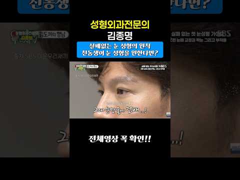 김종국 눈 성형?