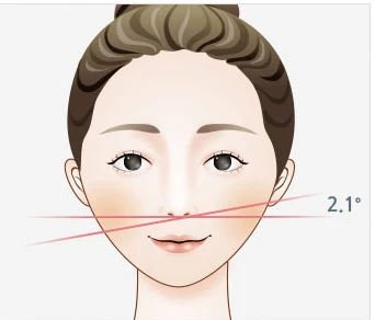 콧기둥 밑면의 수평선과 콧망울이 이루는 각도를 표시한 정면 얼굴 도해