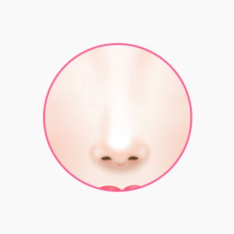 복코 개선