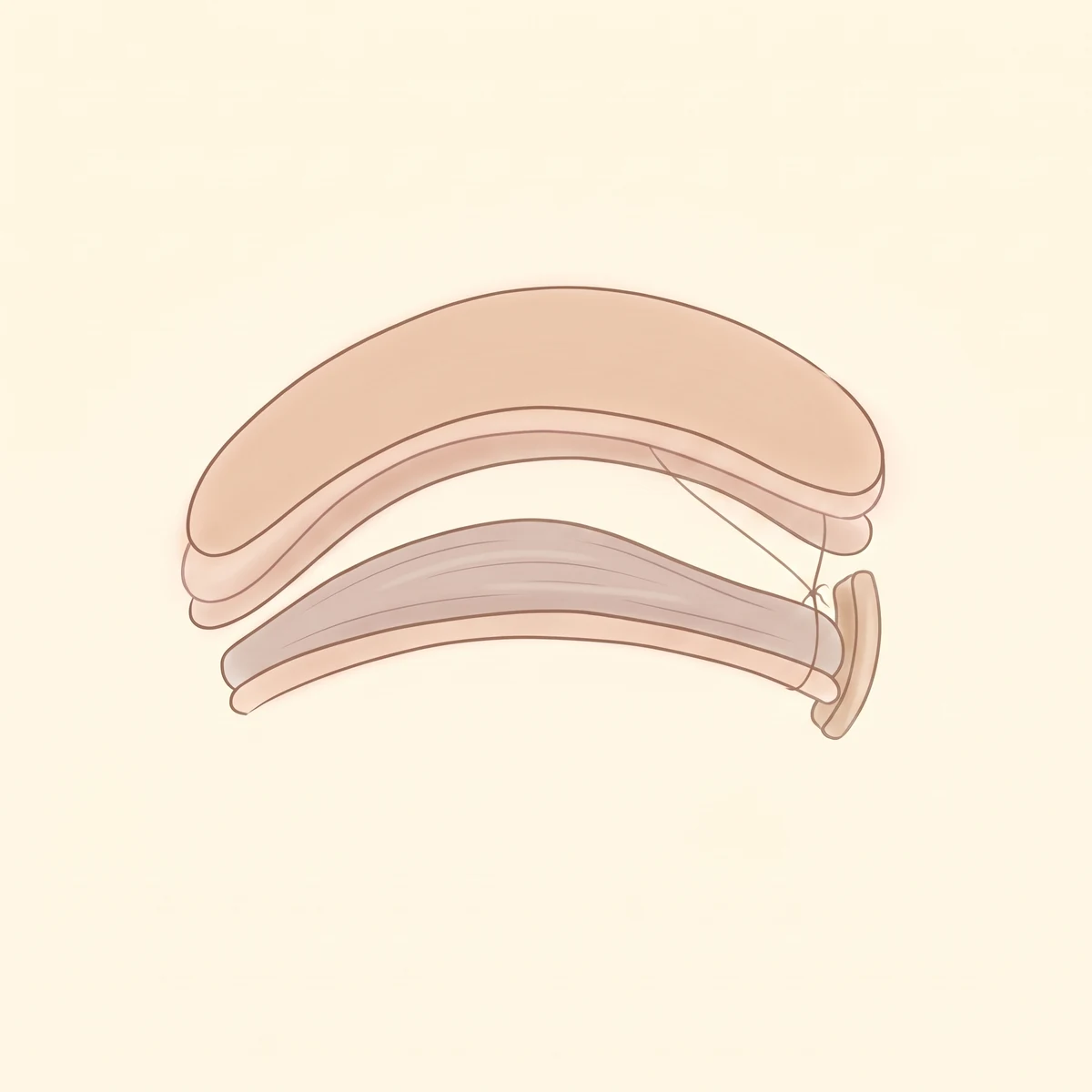 하안검 수술 과정 03 — 근육 · 근막 고정