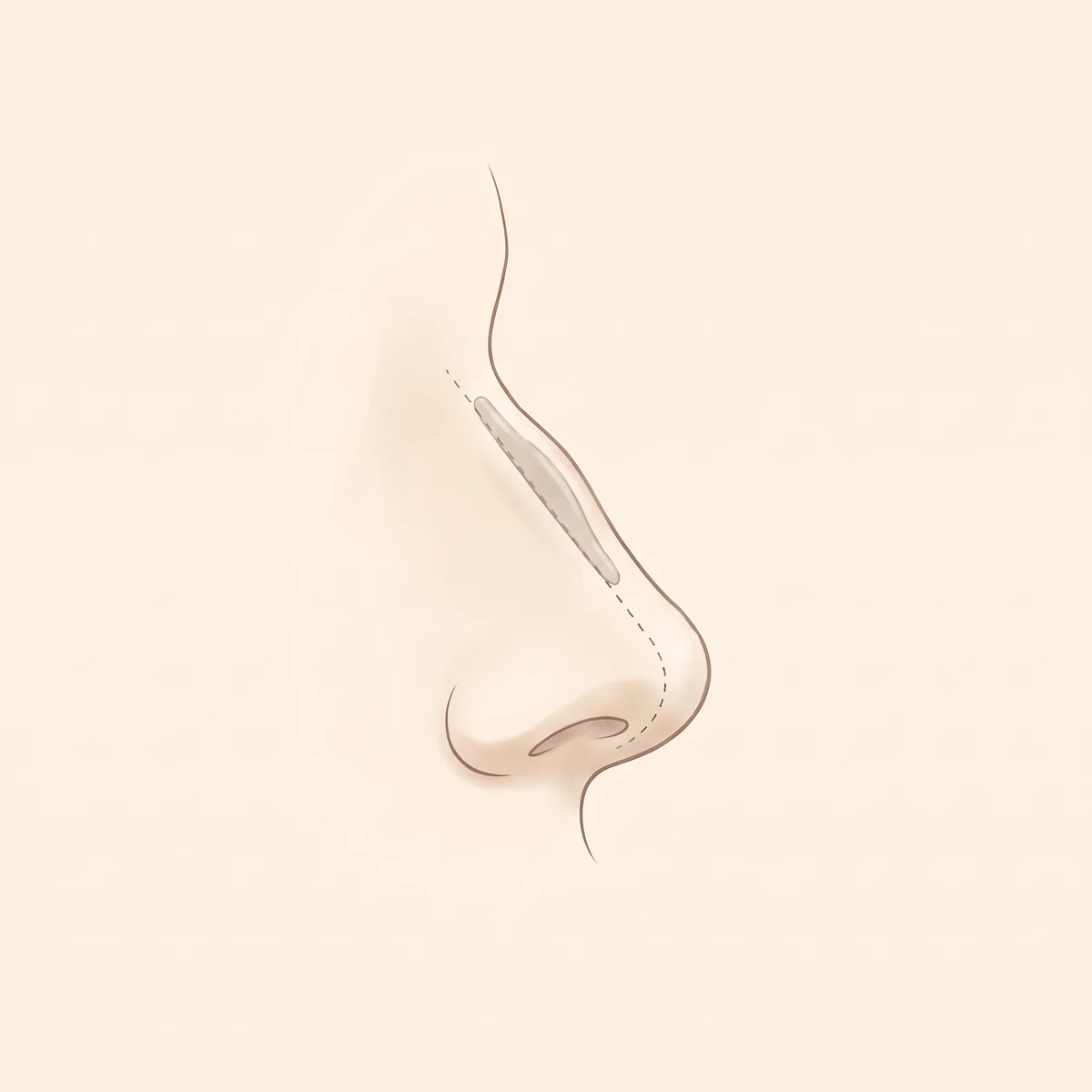 코재수술 진행 과정 01 — 원인 진단 · 시기 판단