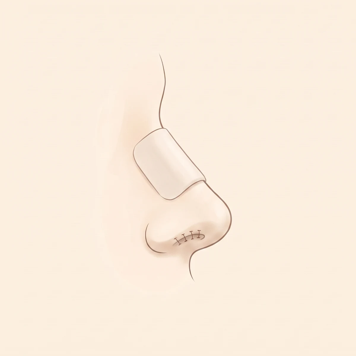 코성형 수술 과정 04 — 봉합 · 경과 확인